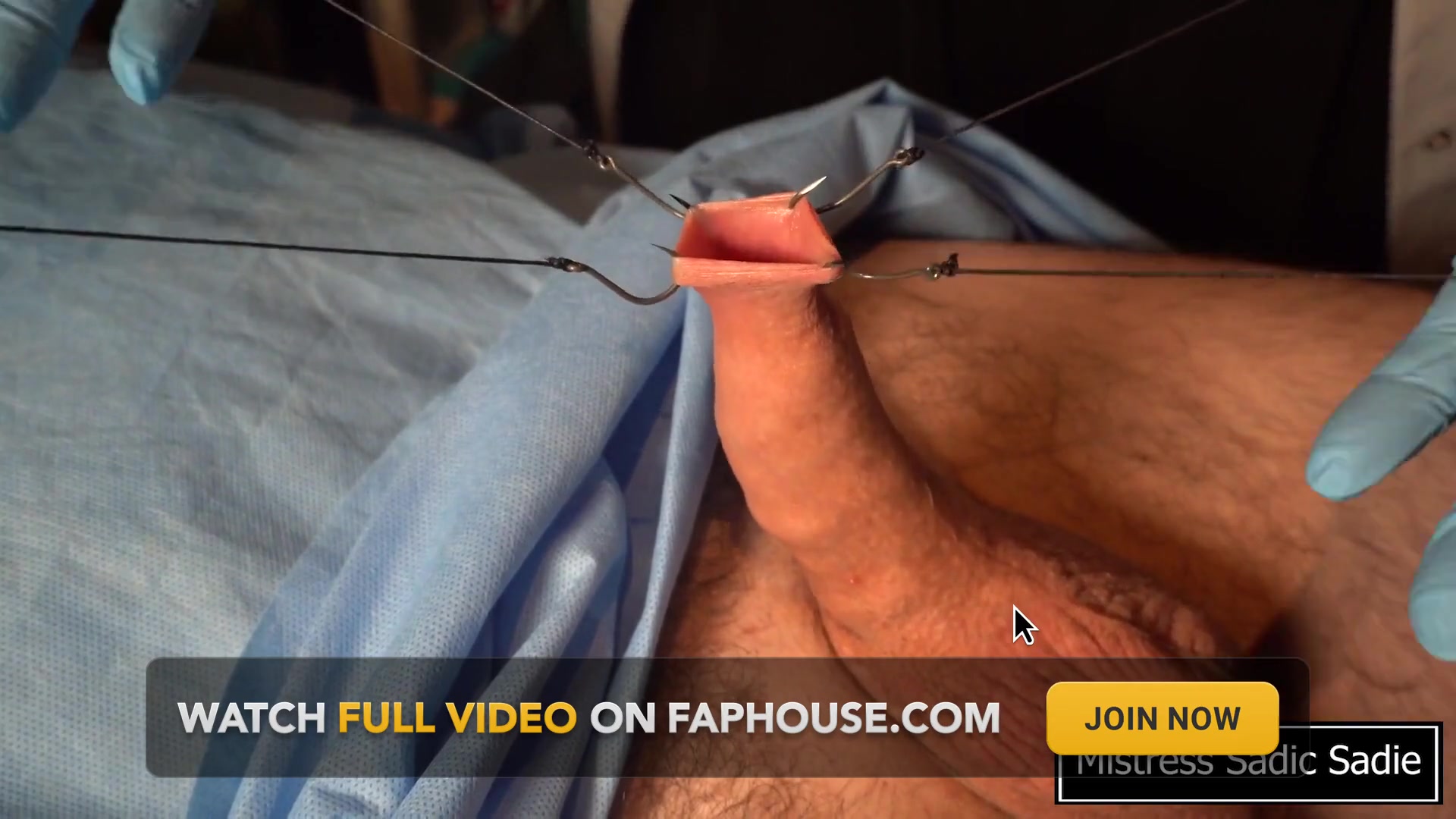 Needle CBT at It's Finest.