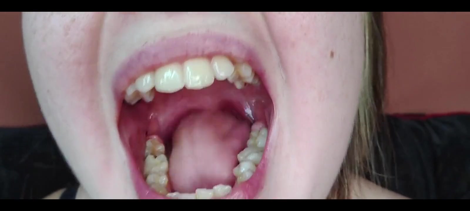 My Mouth, Teeth, Tongue and Throat up Close
